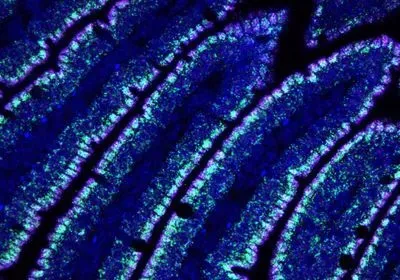 gamma delta t cell intestine gut mouse mice diet nutrient epithelial cell remodeling immune system gamma delta t cell intestine gut mouse mice diet nutrient epithelial cell remodeling immune system